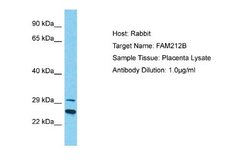 FAM212B Antibody, Novus Biologicals 100 &mu;L; Unconjugated:Antibodies,